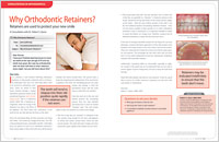 Orthodontic Retainers - Dear Doctor Magazine